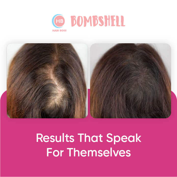 3X Bombshell Hair Growth Spray Women.